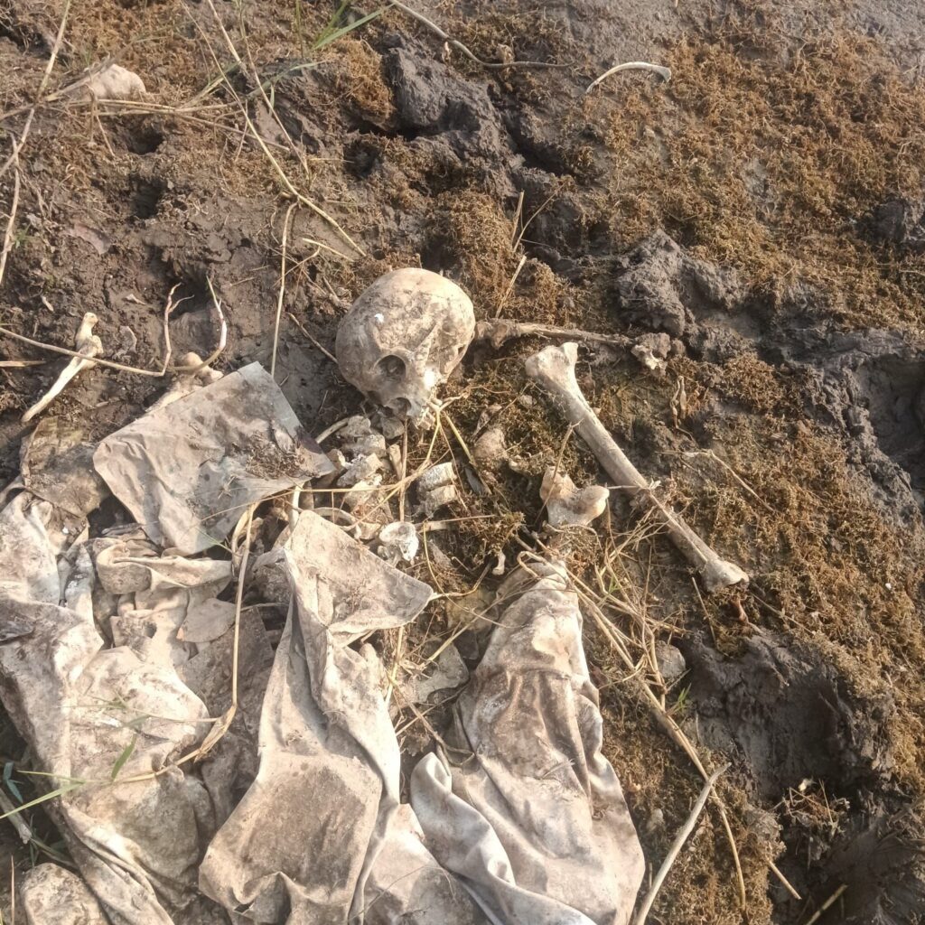 Excitement over discovery of skull and bones